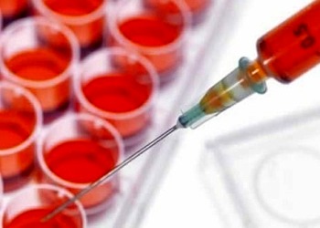 Kök hücre tedavisi ile gençleşmek mümkün mü, yaşlılık hastalıklarına çare mi?