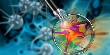 Kanser Hücrelerinin Çoğalmasına Neden Olan Yeni Bir Yolak Keşfedildi