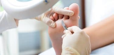 Nasırın ameliyat ile tedavisi