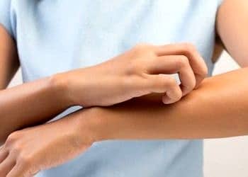 Ciltte kaşıntının 9 önemli nedeni