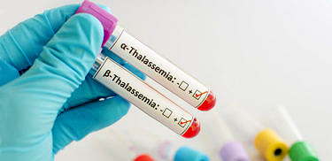 Alfa Talasemi hastalığı ve Beta Talasemi 