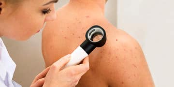 Koltuk altı ve kasık bölgesindeki yaraları/apseleri ihmal etmeyin!