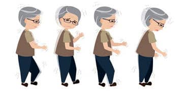 Parkinson hastalığı neden olur? Belirtileri, teşhisi ve evreleri