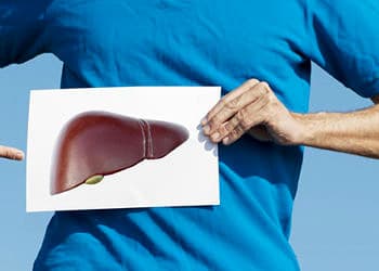 Karaciğeri harap eden sinsi hastalık: NASH, Non-Alkolik Yağlı Karaciğer Hastalığı