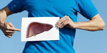 Karaciğeri harap eden sinsi hastalık: NASH, Non-Alkolik Yağlı Karaciğer Hastalığı