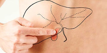 Safra kesesi hastalıkları ve taşı neden olur? Belirtileri ve tedavisi