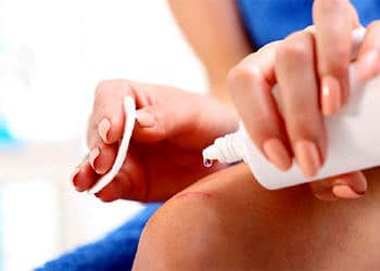 Yara nasıl hızlı iyileşir? Yara çeşitleri ve tedavi yöntemleri