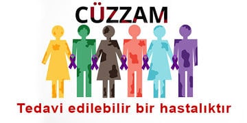 Cüzzam (Lepra) nedir? Nasıl bulaşır? Belirtileri ve tedavisi