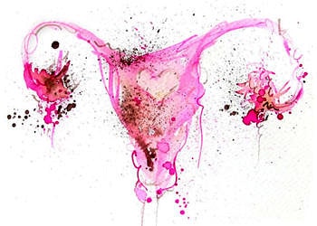 Endometriozis (çikolata kisti) nedir? Belirtileri, nedenleri ve tedavisi