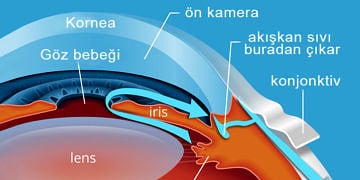 Göz tansiyonu (Glokom) nedir? Nedenleri, belirtileri ve tedavisi