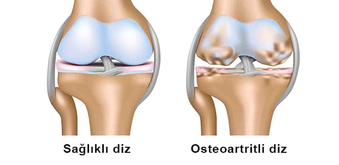 nurofen articulatii