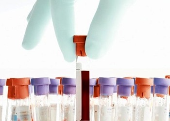 Anemi (kansızlık) nedir, neden olur? Belirtileri ve tedavisi