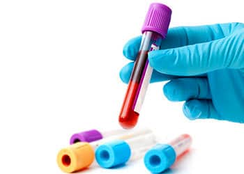 Kolon kanseri neden olur? Belirtileri, tedavi yöntemleri ve ameliyatı