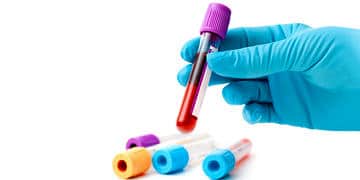 Kolon kanseri neden olur? Belirtileri, tedavi yöntemleri ve ameliyatı