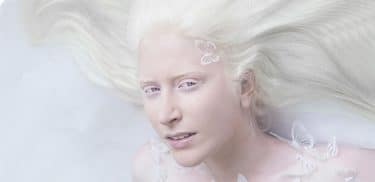 Albinoların cilt kanseri