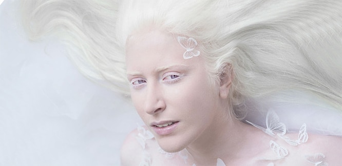albino albinizm nedir neden olur albinonun belirtileri ve tedavisi
