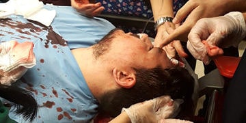 Acilde doktora parke taşıyla saldırı! Yaralanan doktor yoğun bakımda