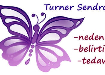 Turner Sendromu nedir? Belirtileri, nedenleri ve tedavisi