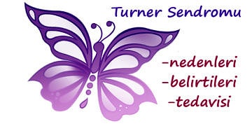 Turner Sendromu nedir? Belirtileri, nedenleri ve tedavisi