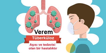 Verem nedir, neden olur? Tüberküloz belirtileri, tedavisi ve aşısı