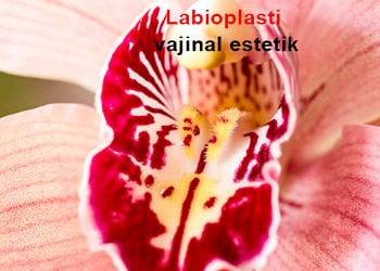 Labioplasti nedir? Labiaplasty ameliyatı nasıl yapılır, tehlikeli midir?