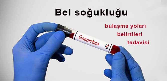 bel soguklugu nedir belirtileri tedavisi ve korunma yollari