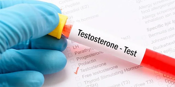 testosteron nedir neye yarar erkek sagligina etkileri nelerdir
