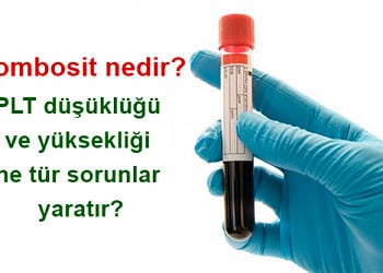 Trombosit nedir? PLT düşüklüğü ve yüksekliği ne tür sorunlar yaratır?
