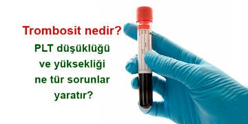 Trombosit nedir? PLT düşüklüğü ve yüksekliği ne tür sorunlar yaratır?