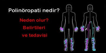 Polinöropati nedir? Neden olur? Belirtileri, türleri ve tedavisi