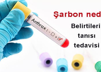 Şarbon nedir? Nasıl bulaşır? Belirtileri ve tedavisi