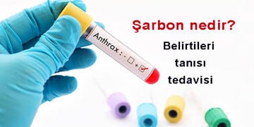 Şarbon nedir? Nasıl bulaşır? Belirtileri ve tedavisi