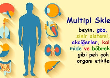 Multipl Skleroz tedavisi ve MS hastalığı ile yaşama rehberi