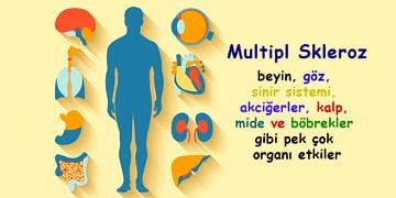 Multipl Skleroz tedavisi ve MS hastalığı ile yaşama rehberi