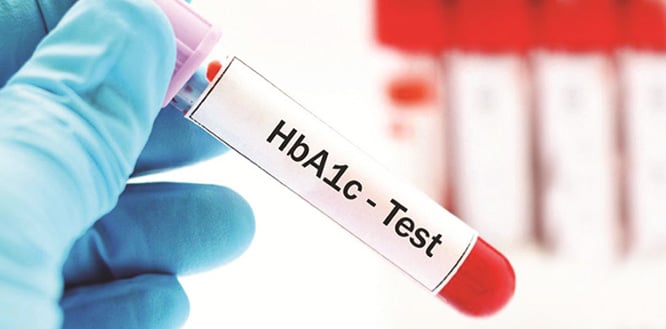 HbA1c testi