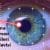 Retina nedir? Yırtılması nasıl önlenir? Hastalıkları ve tedavisi