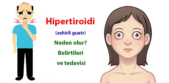 hipertiroidi zehirli guatr nedir neden olur belirtileri ve tedavisi