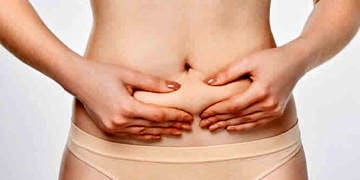 Yağ aldırma mı, yoksa karın germe mi, hangi yöntem daha etkili?