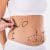 Gurbetçilerin liposuction ve vücut şekillendirme için Türkiye'de (özellikle İstanbul) en çok tercih ettiği En İyi Doktorlar