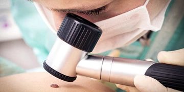 Ben aldırma ameliyatı nasıl uygulanır?