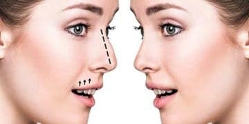 Burun Estetiği Ameliyatı: Kimler yaptırabilir, ne kadar sürer?