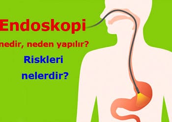 Endoskopi nedir? Neden ve nasıl yapılır? Riskleri nelerdir?