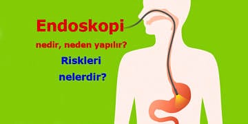 Endoskopi nedir? Neden ve nasıl yapılır? Riskleri nelerdir?