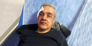 Hasta yakınının saldırısına uğrayan Dr. Hasan Cabbar ağır yaralandı