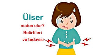 Ülser nedir, neden olur? Belirtileri ve tedavi yöntemleri