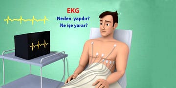 EKG nedir, nasıl yapılır? Elektrokardiyografi testi ne işe yarar?