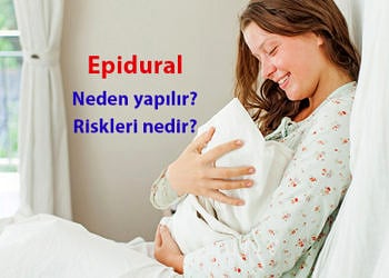 Epidural nedir? Ne işe yarar? Neden ve nasıl yapılır? Riskleri…