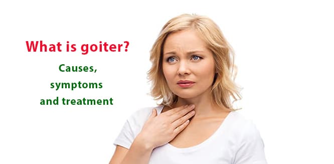 What Is Goiter Causes Symptoms And Treatment Methods