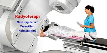 Radyoterapi nedir? Kanser tedavisinde nasıl uygulanır? Yan etkileri
