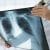 Röntgen nedir, nasıl çekilir? Radyografik muayene ve zararları